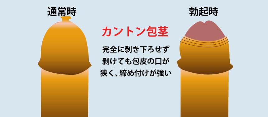 知識なく親が剥くのは危険!?