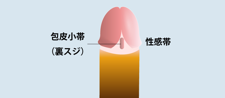 包皮小帯切除（メスを入れる）で早漏を改善